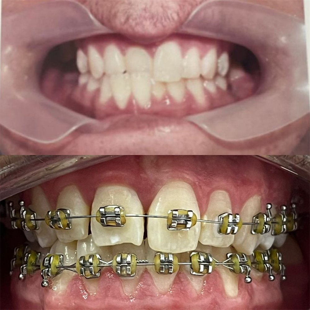Caso antes e depois — AK Odontologia