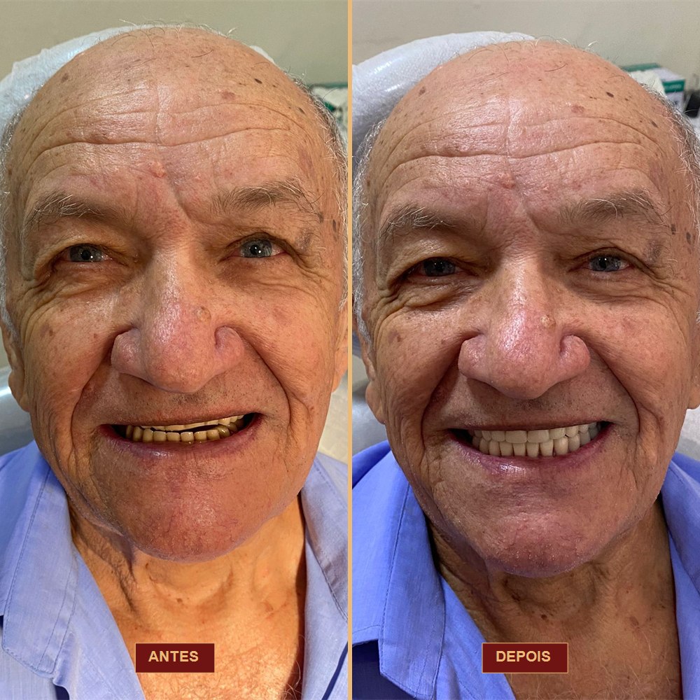 Caso antes e depois — AK Odontologia