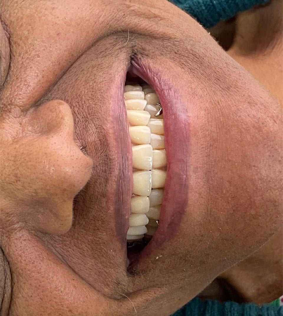 Caso de antes e depois — AK Odontologia